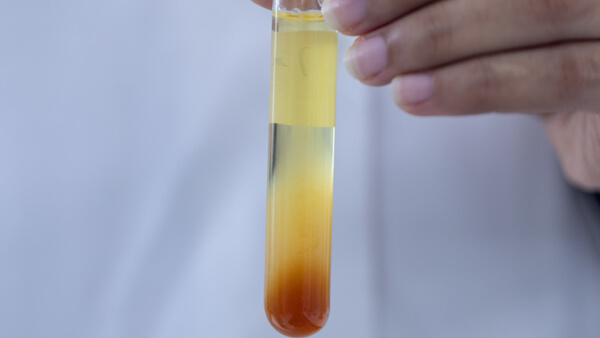 Emulsion & suspension & foam analysis